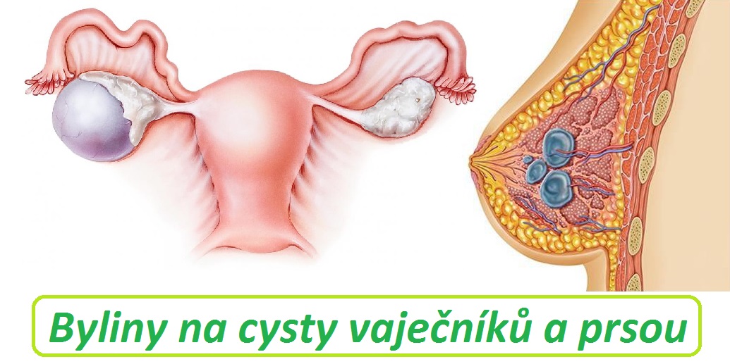 Cysty byliny bylinky babské rady léčba bez léků bez operace prsa vaječníky