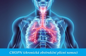 Tinktura Chopn Chronicka Obstrukcni Plicni Nemoc Konopice