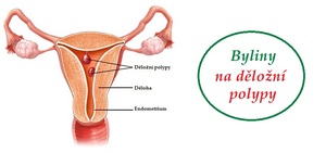 delozni polypy byliny bylinky lecive rostliny lecba bez operace